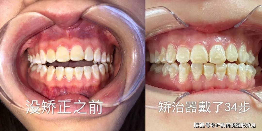抖音跳伞在哪里？快来体验刺激的天空之旅